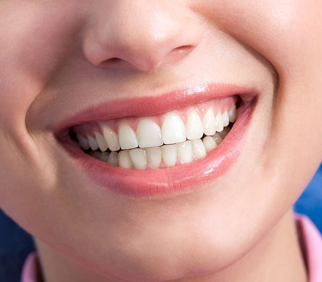 Is Teeth Whitening For You | Ellwood Dental | General and Family Dentist | SW Edmonton