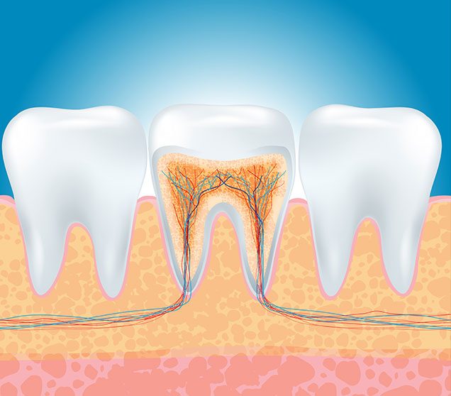 What is Root Canal Therapy | Ellwood Dental | General and Family Dentist SW Edmonton