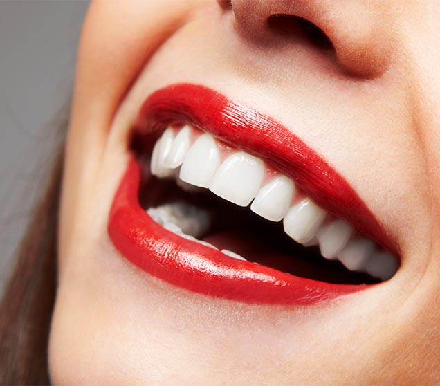 Composite or Porcelain Veneers | Ellwood Dental | General and Family Dentist SW Edmonton